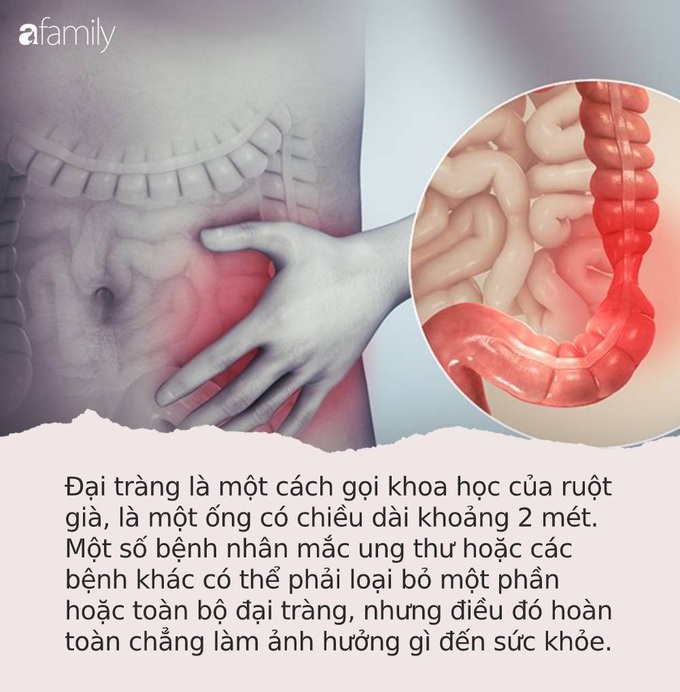 Đây là những cơ quan nội tạng dù có phải "cắt bỏ" bạn vẫn sẽ sống khỏe chẳng ảnh hưởng gì - Ảnh 3.