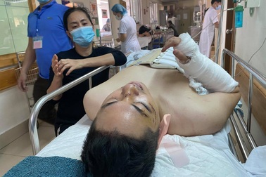 Lời kể của nam nhân viên bị rơi trong vụ thủng sàn chung cư Meco Complex