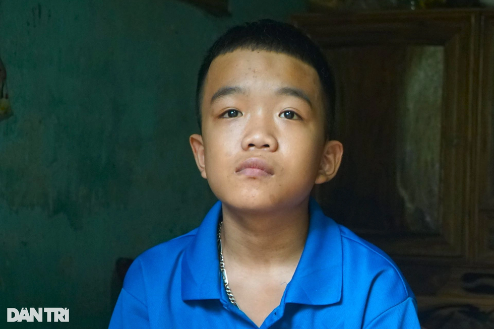 Sóng gió cuộc đời người đàn bà mang khuôn mặt quỷ - 5 Sóng gió cuộc đời người đàn bà mang khuôn mặt quỷ - 5