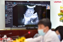 Nền tảng Telehealth hỗ trợ hội chẩn hơn 1.800 ca Covid-19 nặng