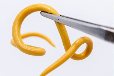 Người phụ nữ 15 năm cầu cứu khắp các bệnh viện vì nhiễm ký sinh trùng ở chó