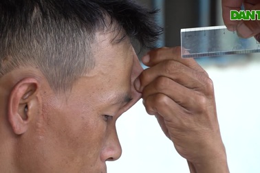 Dị nhận miền Tây có làn da cao su