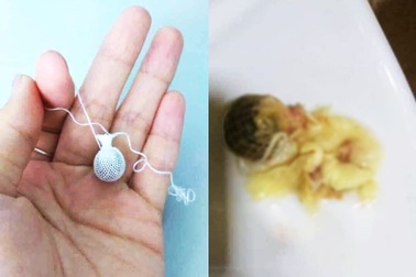 "Kén" đặt phụ khoa được quảng cáo như thần dược: Nhận định từ chuyên gia