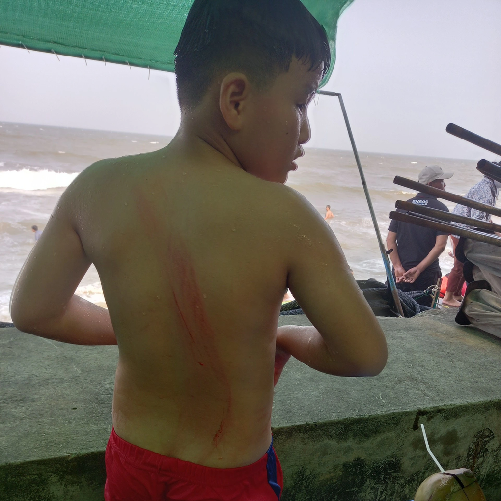 Làm rõ thông tin du khách bị thương khi tắm gần chòi canh hình bàn tay - 2 Làm rõ thông tin du khách bị thương khi tắm gần chòi canh hình bàn tay - 2