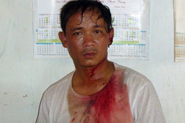 Thêm một vụ lâm tặc hung hãn chém người