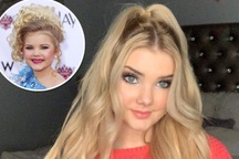 Hoa hậu "nhí" từng tiêm botox năm 4 tuổi "lột xác" ở tuổi trưởng thành