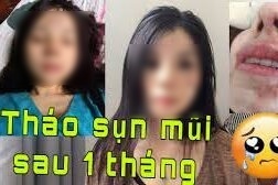 Sự thật đằng sau những bài đăng cổ vũ phẫu thuật thẩm mỹ trên mạng - 4