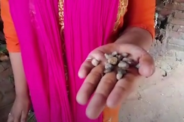 Kỳ lạ cô bé khóc ra sỏi đá