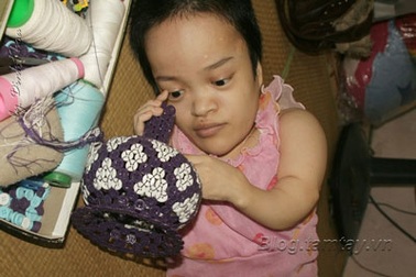 Ước mơ của “cô gái thủy tinh”