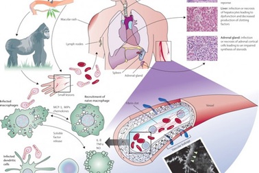 Cách phòng ngừa bệnh lây truyền Ebola chết người