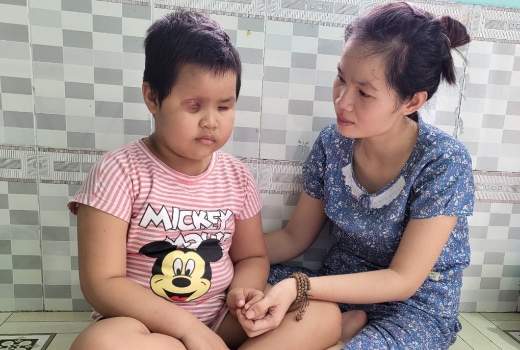 Người mẹ nghèo cầu xin cứu con gái 6 tuổi mù lòa - 2 Người mẹ nghèo cầu xin cứu con gái 6 tuổi mù lòa - 2