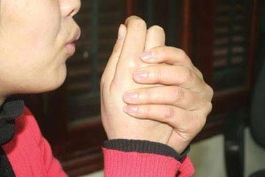 Trị chứng lạnh tay, chân