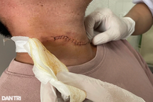 Xử lý nghi phạm cứa cổ, cướp tài sản ở bờ biển Phú Quốc ra sao?