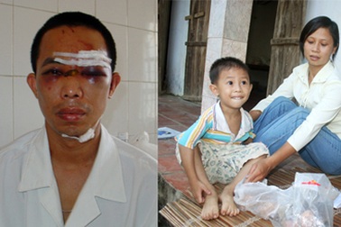 Khởi tố đối tượng đánh trọng thương thầy giáo