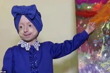 Cuộc đời của thần đồng hội họa 10 tuổi nhưng có cơ thể của bà lão 80