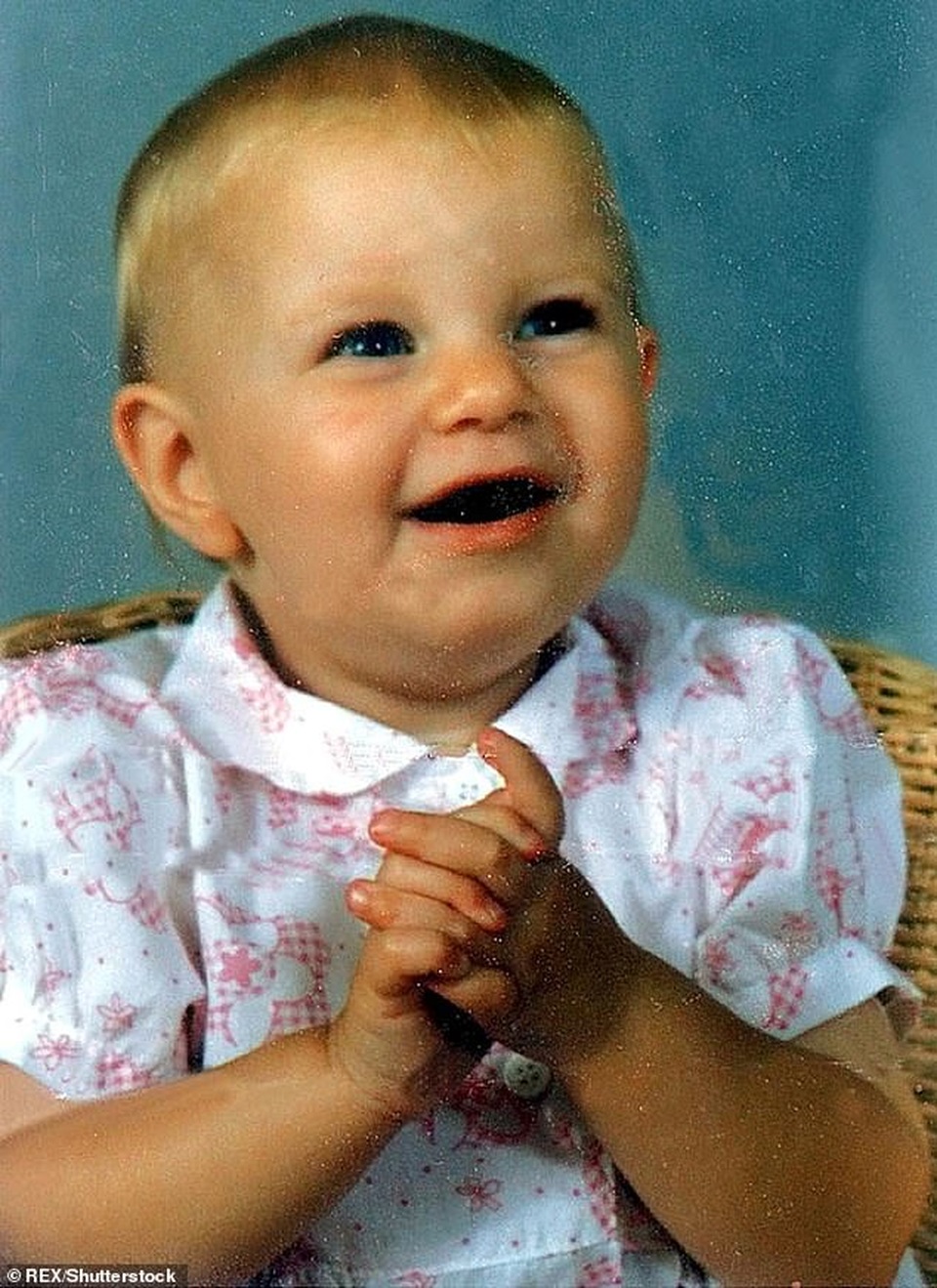 Hạnh phúc bất ngờ của cô gái từng bị bỏng đến biến dạng - 1