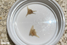 Bé 1 tuổi nguy kịch sau khi ăn cháo lươn: Viện phí gần 100 triệu đồng