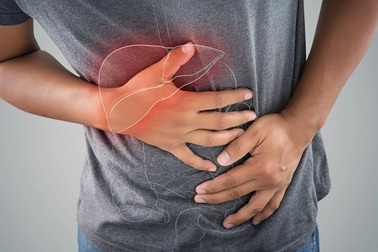 Phát hiện ung thư gan từ vết bầm tím quanh rốn