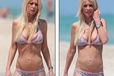 Sốc với thân hình “tiều tụy” của “sao” Hollywood