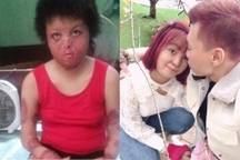 Hạnh phúc mới của cô gái Hà Nội bị chồng cũ tẩm xăng thiêu sống