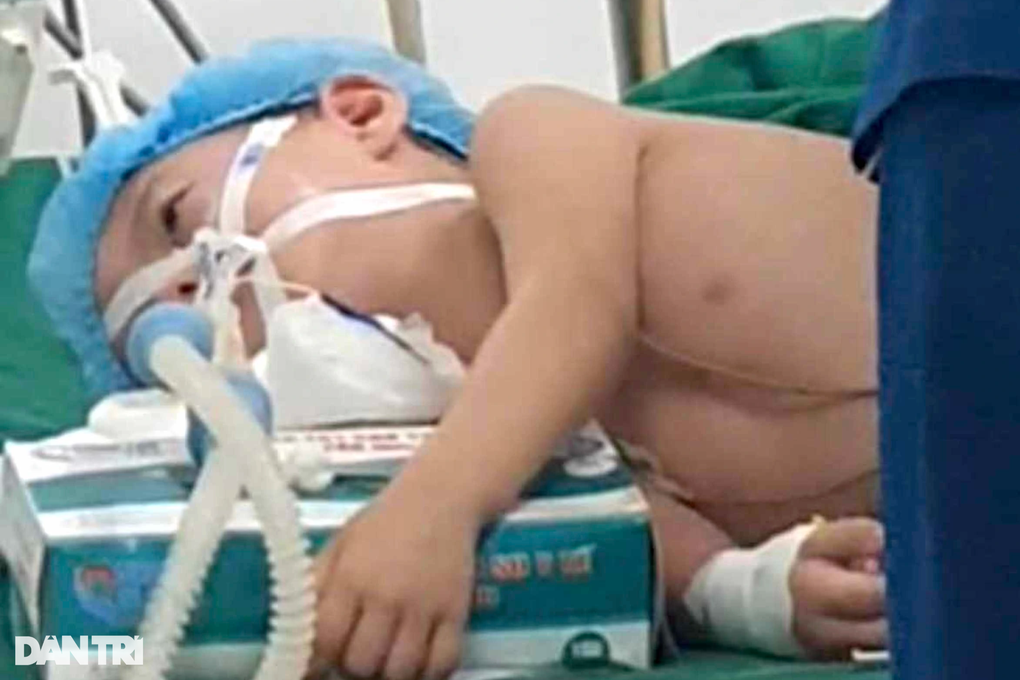 Ánh mắt cầu cứu của bé gái 4 tuổi toàn thân co cứng sau cơn sốt cao - 1 Ánh mắt cầu cứu của bé gái 4 tuổi toàn thân co cứng sau cơn sốt cao - 1