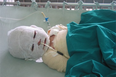 Mẹ ơi, trông em bé này thương thế!