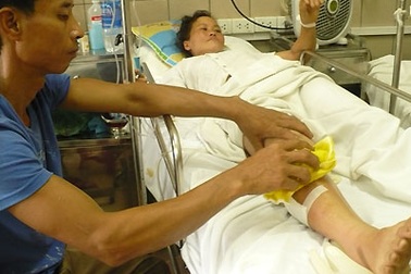 Bị rắn lục cắn, bé 9 tuổi rối loạn đông máu toàn thân