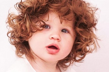 Bé gái “xinh như thiên thần” do mắc hai chứng bệnh rất hiếm gặp