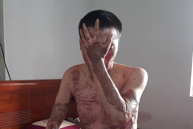 Đau nhói lòng gia cảnh người đàn ông bị đồng nghiệp ra tay tàn độc