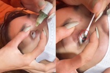 Rước họa vì "bắt sâu mắt" tại spa