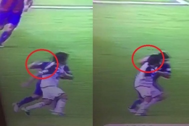 Đấm đối thủ, Luis Suarez vẫn thoát thẻ đỏ