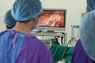 Thực hiện thành công kỹ thuật cắt gan nội soi cho bệnh nhân ung thư gan