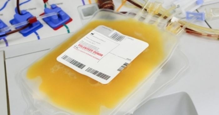 Sau cơn đau đầu, buồn nôn, người đàn ông phải truyền 100 đơn vị huyết tương - 2