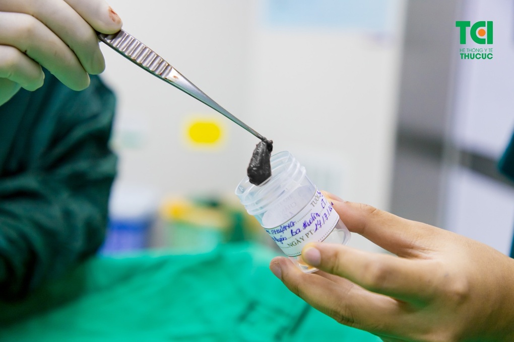 U nang tuyến Bartholin - Bệnh vặt nhưng chớ nên coi thường - 3 U nang tuyến Bartholin - Bệnh vặt nhưng chớ nên coi thường - 3