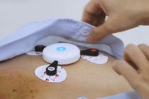 Bệnh viện ở TPHCM có thiết bị "độc" hình cánh quạt chống tái phát đột quỵ