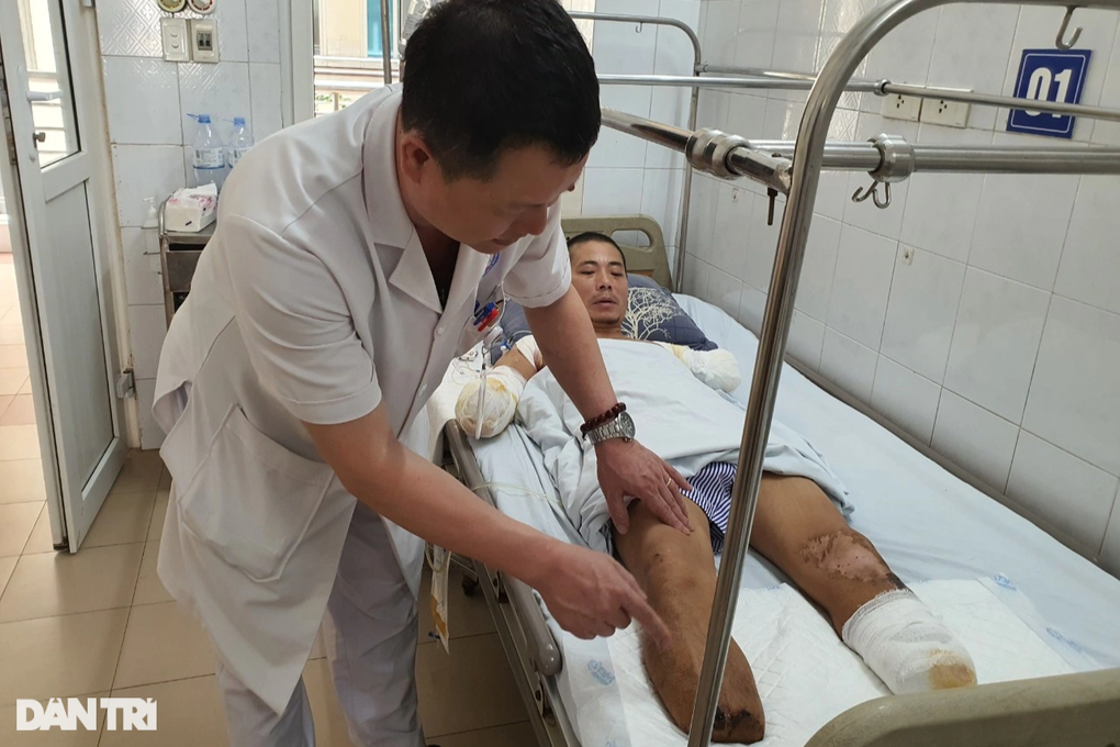 Ám ảnh người bố 2 con phải cắt bỏ tứ chi sau cú phóng điện kinh hoàng - 2