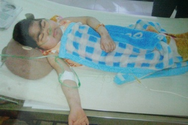 Tính mạng “bé gái 7 năm lấy bệnh viện làm nhà” đang nguy kịch 