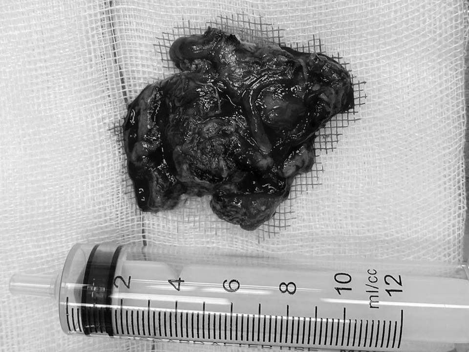 Cô gái trẻ thường xuyên động kinh vì bệnh lý nguy hiểm - 3