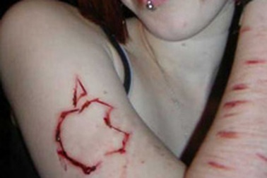 Thiếu niên Pháp với chứng tự hành xác 