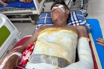 Con gái khẩn cầu cứu cha nghèo đơn thân bị điện giật bỏng nặng khi làm thuê