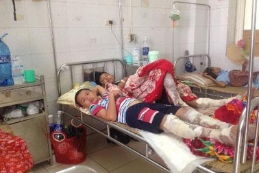 Không khởi tố vụ đốt lửa trại làm 75 người bỏng xăng