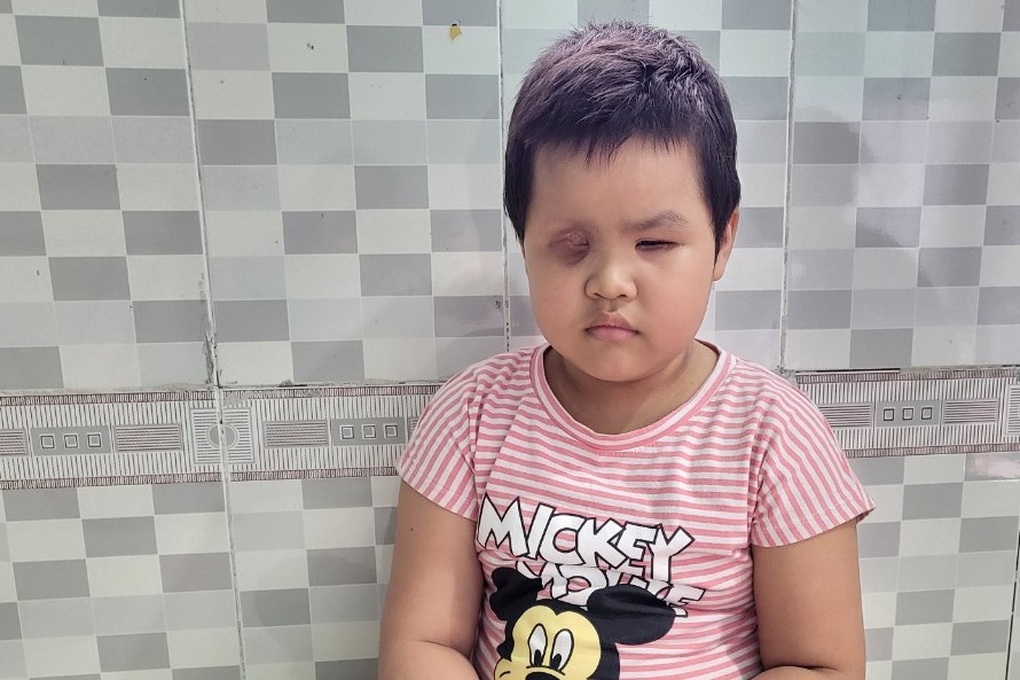 Người mẹ nghèo cầu xin cứu con gái 6 tuổi mù lòa - 1 Người mẹ nghèo cầu xin cứu con gái 6 tuổi mù lòa - 1