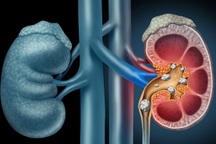 Nghiên cứu mới tại BV Chợ Rẫy về mối liên quan giữa gan nhiễm mỡ và thận