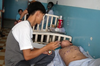 Bác sĩ tử vong vì thủy đậu