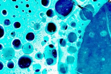 Liệu pháp miễn dịch chống ung thư: Đột phá y học của năm 2013