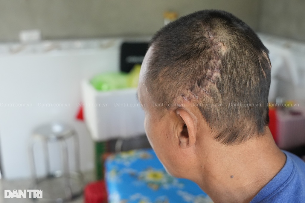 Bạn đọc ủng hộ hơn 2,1 tỷ đồng tới gia đình có hoàn cảnh như bị trời đày - 4 Bạn đọc ủng hộ hơn 2,1 tỷ đồng tới gia đình có hoàn cảnh như bị trời đày - 4