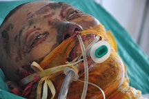 Vợ nghèo đau đớn cùng lúc nhận tin chồng ung thư, con bị bỏng nặng