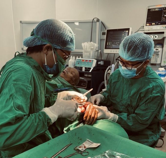 Ekip phẫu thuật gồm các bác sĩ Khoa Điều trị theo yêu cầu đứng đầu là TS. Dương Mạnh Chiến và ekip Khoa Gây mê hồi sức đã tiến hành phẫu thuật cho người bệnh.