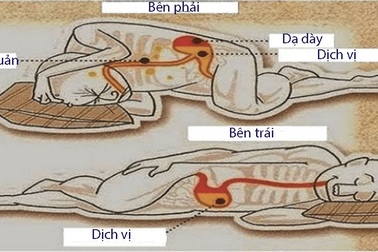 5 bí quyết "nhẹ gánh" dạ dày