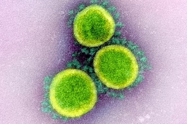 Tìm ra điểm yếu trong lớp màng của coronavirus
